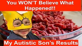 UNBELIEVABLE Ketovore Keto Results for my Autistic Son! ASD Carnivore Diet Results #autism #shorts