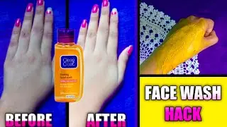 How To Use Face Wash For Glowing Oil Free Pimple Free Skin |Pimple Free Skin Tips|skin care|