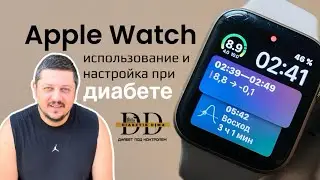 APPLE WATCH И ДИАБЕТ | САХАР КРОВИ НА ЧАСАХ | ТЕХНОЛОГИИ ДИАБЕТА