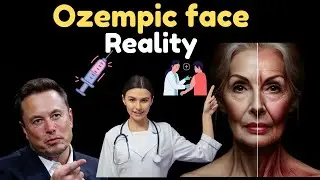 What is Ozempic Face? The SHOCKING Truth About This Trend[2024]