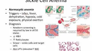 Pediatric Hematology