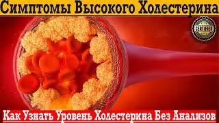 Как узнать уровень холестерина без анализов. Понижаем холестерин без лекарств в домашних условиях.