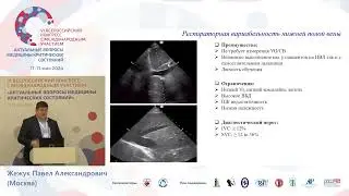 Персонифицир инфузионная терапия септического шока Жежук П.А.