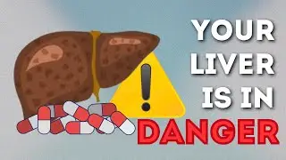 LIVER is DYING! 12 Weird Signs of LIVER DAMAGE you Must Watch