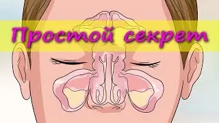 Как быстро ВЫВЕСТИ СЛИЗЬ из организма?