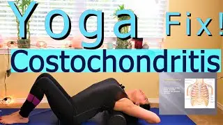 Chest Pain? Yoga Stretching Exercises For Costochondritis Fix!