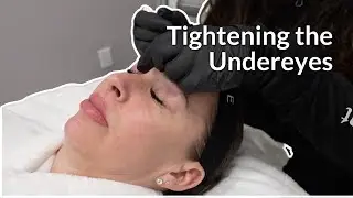 Tightening the Undereyes with HIFU Tight + Lift | Lucere Skin