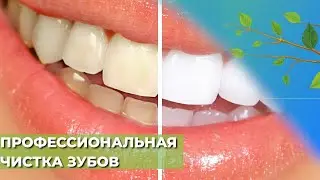 Станут ли зубы белее после профессиональной гигиены?☘️