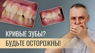 КРИВЫЕ ЗУБЫ? БУДЬТЕ ОСТОРОЖНЫ!