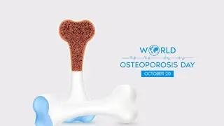 World Osteoporosis Day 20 October 2024 - Theme, Importance, & Bone Health Tips @Dt.sharda