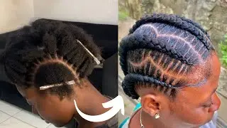 Easiest Way to do stitch Braids/ Beginners friendly tutorial