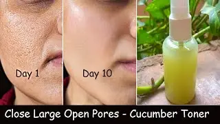 i Sprayed Cucumber Toner on my Face daily & Closed Large Open Pores - Skin Repair & DARK SPOTS