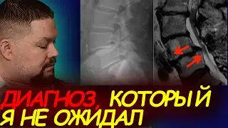 Ежи Сармат: мне грозит инвалидность? Кошмар начался
