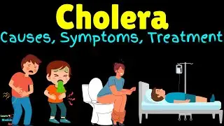 Cholera – Symptoms, Causes, Pathogenesis, Diagnosis, Treatment, Complications, Prevention & Vaccine