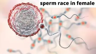 Sperm race 