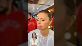 Большие губы до/после 