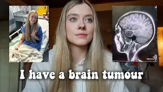 I have a large brain tumour... How they found it, my signs and symptoms.