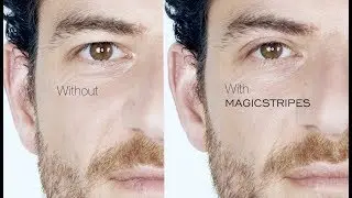 WWW.MAGICSTRIPES.COM - Immediate Eyelid Lifting Without Surgery