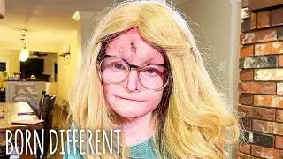 EB Took My Hands And My Hair - But Not My Spirit | BORN DIFFERENT