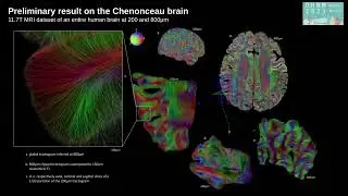 OHBM 2023 | 3069 | Talk | Simon Legeay | High Performance Computing global tractography for ultra-…