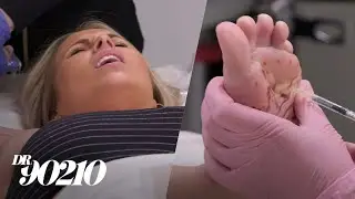 Patient Who Sweats Excessively Learns Injections Hurt Like a Bitch! | Dr. 90210 | E!