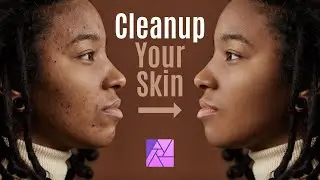 CLEAN UP AND SMOOTHEN YOUR SKIN | PHOTO RETOUCHING | AFFINITY PHOTO FOR IPAD TUTORIAL