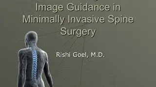 Stereotactic Navigation and Image Guidance in MIS Surgery by Rishi Goel, M.D.