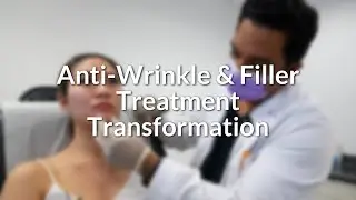 Anti-Wrinkle & Filler Treatment Transformation | Lucere Skin