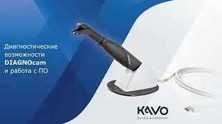 KaVo DIAGNOcam: диагностические возможности и работа с программным обеспечением