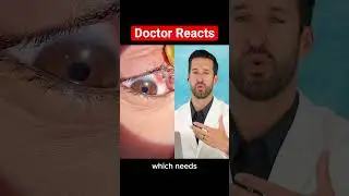 ER Doctor REACTS to Satisfying Foreign Body Removal