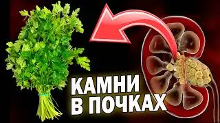 Осторожно! Эти продукты могут вызвать камни в почках