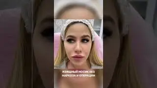 Сужение носа без операции!