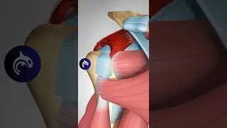 Rotator Cuff Tear and Surgical Repair - 3D Animation