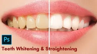 The BEST Way to Teeth Retouching in Photoshop | Complete Tutorial