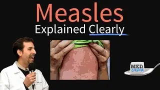 Measles (rubeola) Explained Clearly by MedCram.com