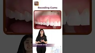 Can you fix receding gums? why does this happen? Dentistry dental gum myths | FMS Dental