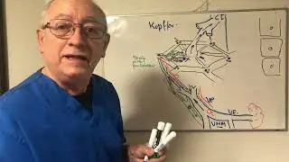 Hipertensión portal. Detalles topográficos del Lobulillo hepatico. Células de Kupffer