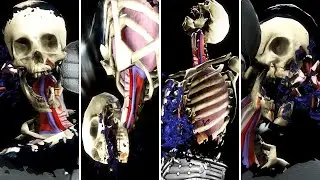 Mortal Kombat 9: Komplete Edition - All X-Ray Attacks
