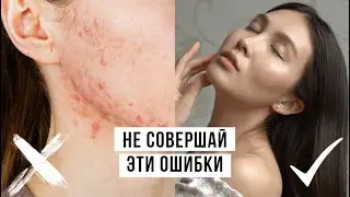 10 ошибок в уходе за кожей лица. Почему появляются прыщи?