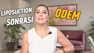 LIPOSUCTION (LİPOSAKŞIN) SONRASI ÖDEM NASIL GEÇER?! | Op. Dr. Leyla Arvas