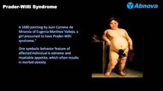 Prader-Willi Syndrome