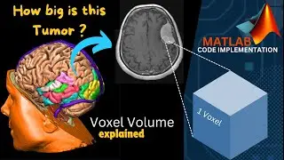 Voxel Volume using Dicom Info | MATLAB