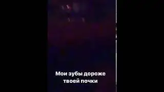 FACE СДЕЛАЛ ГРИЛЗЫ