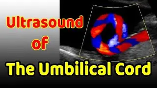 Ultrasound of the Umbilical Cord