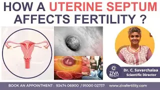 Septate Uterus Treatment  | Fertility and Pregnancy Outcomes | Dr C Suvarchala | ZIVA Fertility