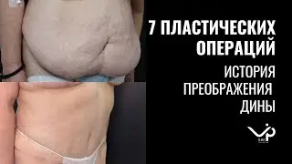 История пациентки Дины: 7 пластических операций, всё только начинается!