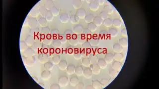 Кровь под микроскопом после короновируса и во время него / после сауны / после ледяного душа