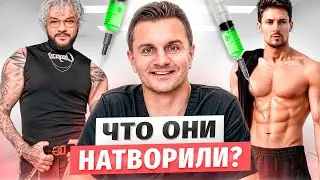 ЗАЧЕМ они это СДЕЛАЛИ? Киркоров, Дуров и Седокова - Реакция пластического хирурга