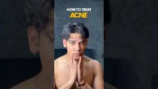 How to treat acne 😍 #acne #pimplefree #skincareroutine