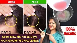 OMG! - 15 Days Hair Growth Miracle Treatment | Grow Long, Thick hair | 100% Works